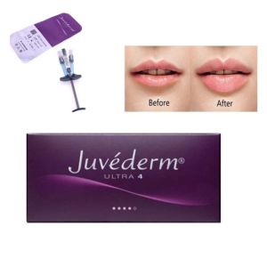 2ml Lip Injections Juvederm Hyaluronic Acid Dermal Filler