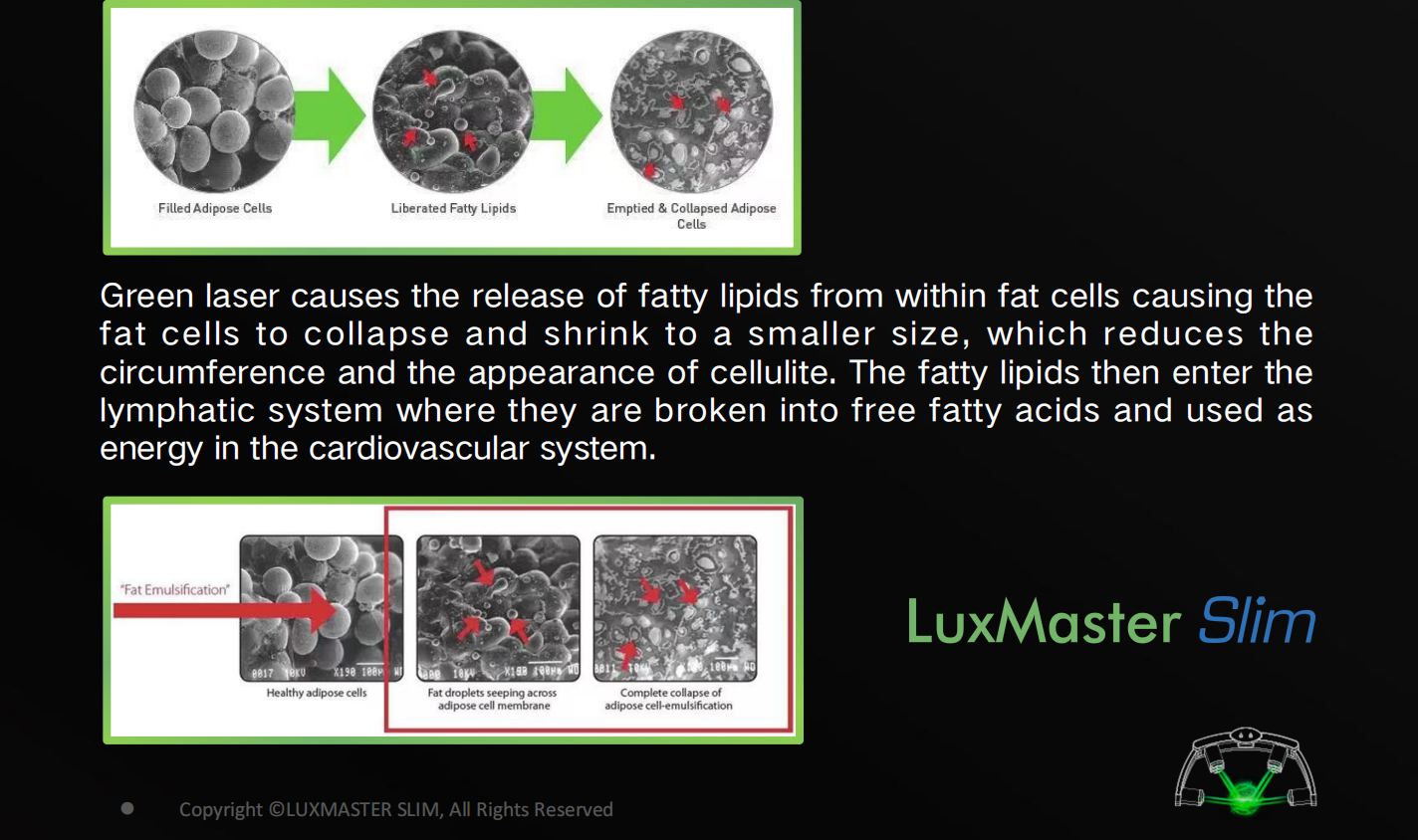 Emerald Laser Fat Reduction Machine With 5332nm 10pcs Diodo