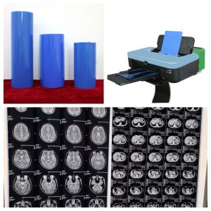 White Opaque Inkjet Medical Film With Glossy Surface Finish 11x14