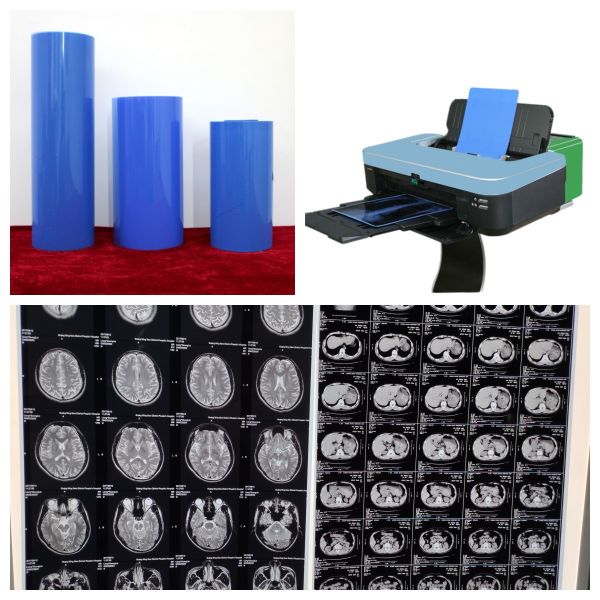 Buy White Opaque Inkjet Medical Film With Glossy Surface Finish 11x14 at wholesale prices