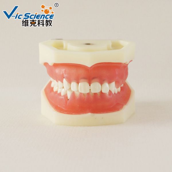Buy Professional Medical Dental Study Models VIC-L5 Peridontal Disease Model at wholesale prices
