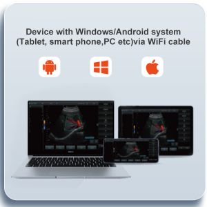 Wifi Yonker Double Probe Mini Handheld Cow Pet Animal & Portable Machine Vet