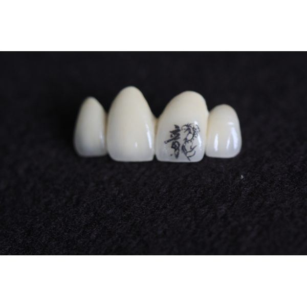 Buy PFM Dental Crown Image Customization with personalized customized patterns at wholesale prices