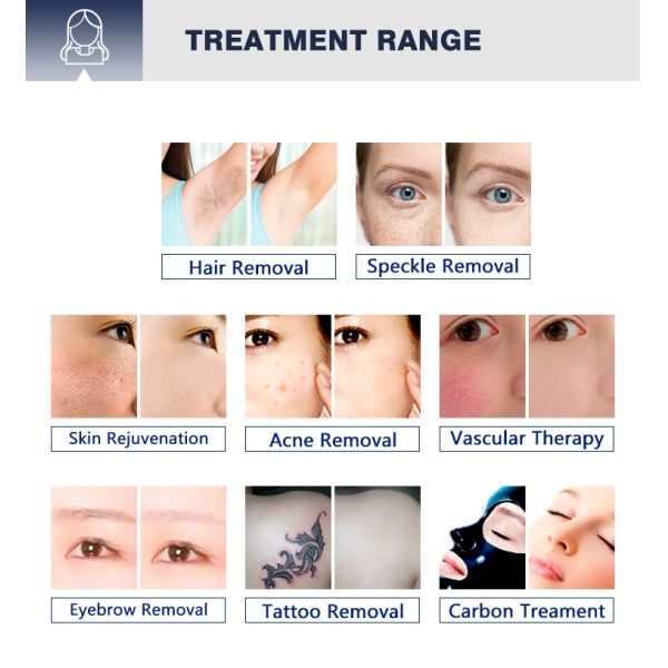 Portable2 in 1 permanent nd yag ipl e light opt hair tattoo removal carbon peeling beauty machine