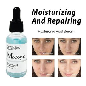 Mopoyat hyaluronic Acid Serum