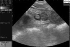 Digital Veterinary Ultrasound Scanner