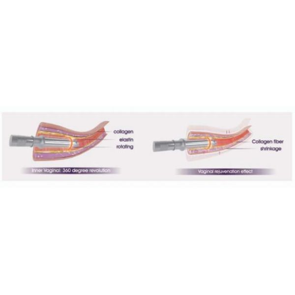 TP[AABW3S`9LB[NM$QKY3U