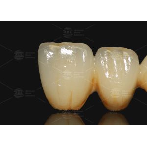 A3 A3.5 Porcelain Fused To Metal Co Cr And Ceramic Dental Crown PFM Cad Cam