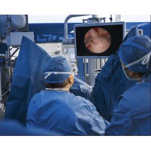 Gynecology Hysteroscopy supporting equipment for endometrial polyps, submucous