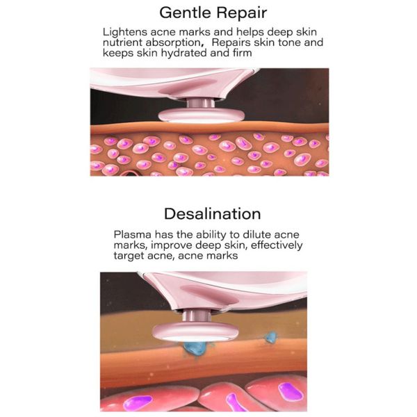 Mini Cold CE Plasma Ozone Pen Dark Circles Removal Pore Clean Skin Lifting