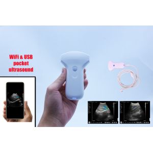 Portable Wireless Convex Linear Ultrasound Probe Color Doppler Lithium Battery