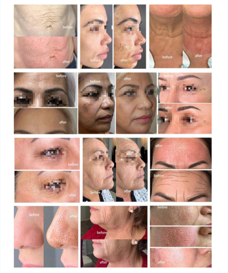 Hot Cold 2 In 1 Plasma Machine For Facial Lifting Therapy Hot Cold Plasma