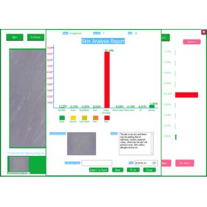 200X Usb Digital Microscope