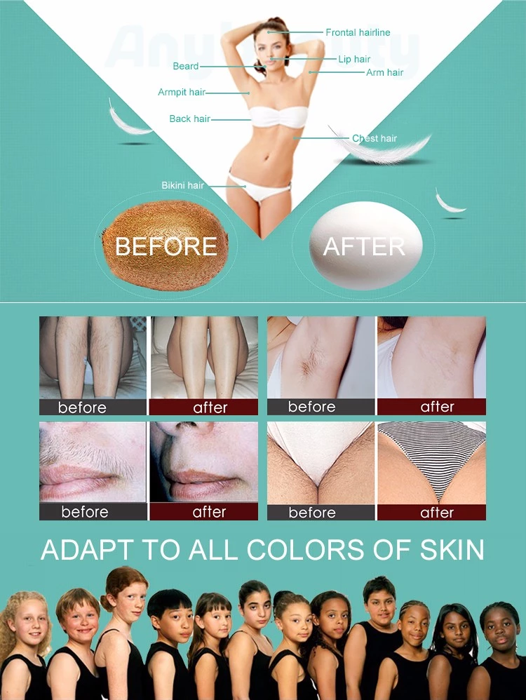 Hair Removal 13*39mm2 755nm 3500W Diode Laser Machine