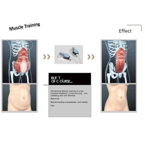 CE 220V LaserTell Ems Electric Muscle Stimulation Unit