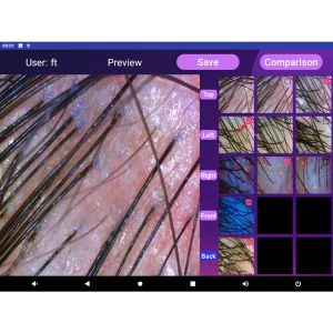 18.5" HD AI Hair Analyzer Machine Android 10 With Microscopic Scanning Hair