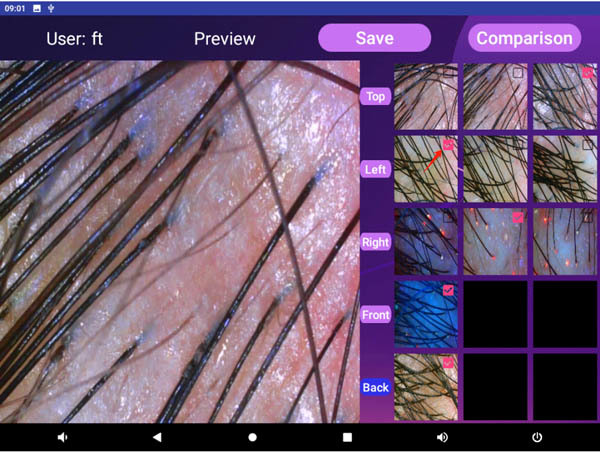 AI Hair Analysis Testing Machine Android 10 50hz / 60hz Hair And Scalp Testing Machine