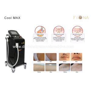 China Fast Safe Commercial Laser Hair Removal Machine Painless Permanent Treatment on sale