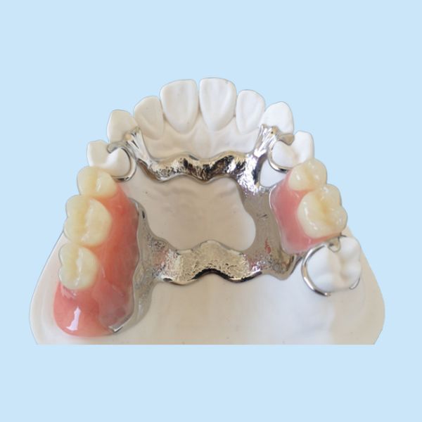 OEM 3D Printer PFM Dental Crowns Bridge High Biological Intermiscibility