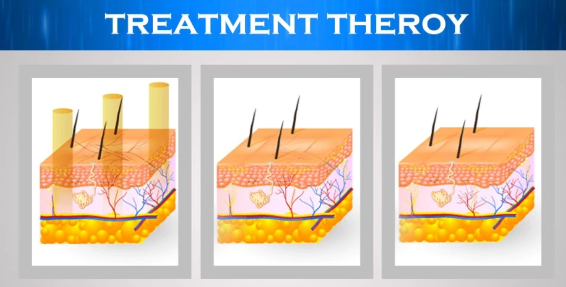 980 Nm Skin Tightening Machine / Diode Laser Vascular Spider Removal Device