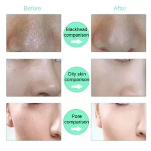 Face Washing Machine Electric Soft Silicone Facial Brush Cleanser Massage