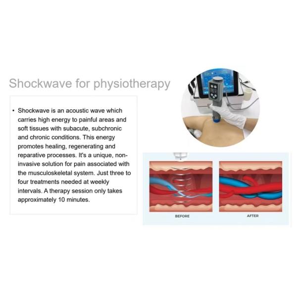 Multifunction Smart Tecar Therapy Machine Shockwave ED Treatment