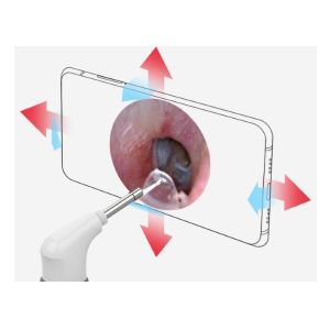 Connected Ipad Ios Android 1280*720 Pixels Wifi Video Otoscope