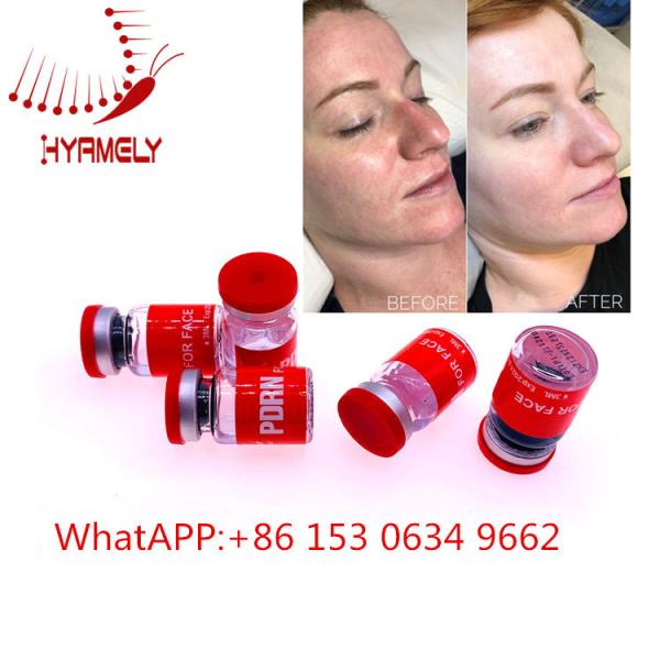 Buy Anti Aging Meso Serum Injection With Hyaluron Pen Dermal Filler at wholesale prices