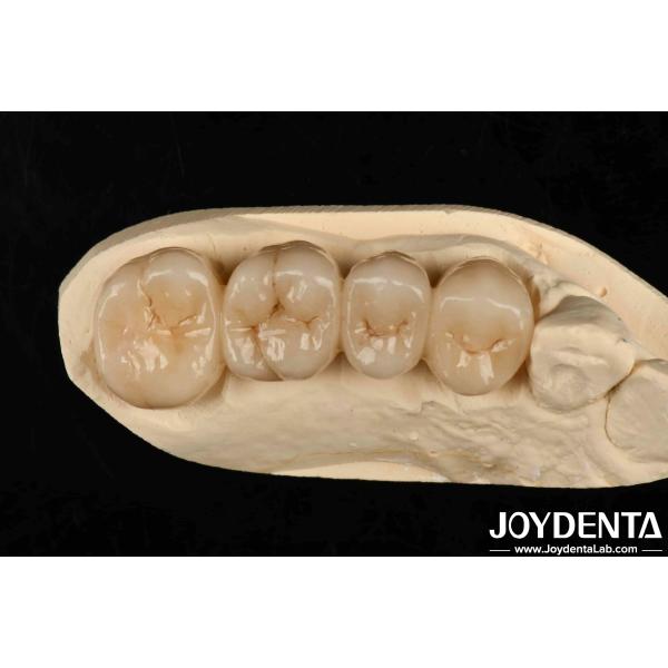 Buy Multilayer Full Zirconia White Style With Layers High Translucency High Resistance To Cracking at wholesale prices