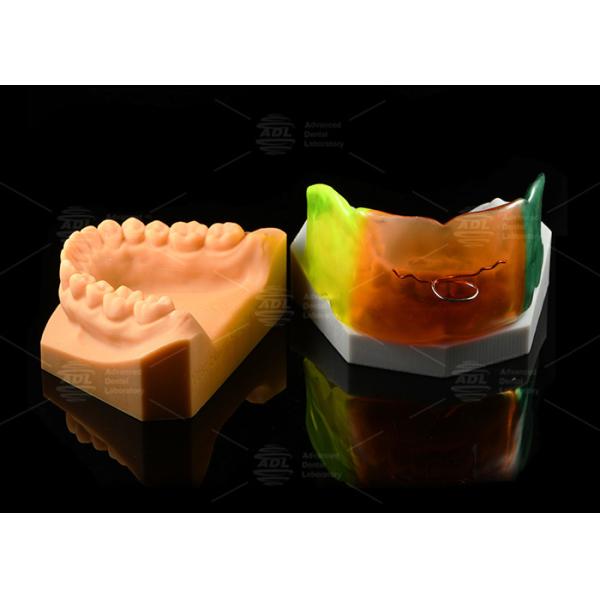 Adjustable Medical Silicone Vestibular Shield Breathable Orthodontic Functional