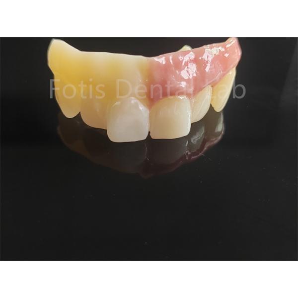 Buy Monolithic Zirconia Layered With Porcelain Computer Aided Design at wholesale prices