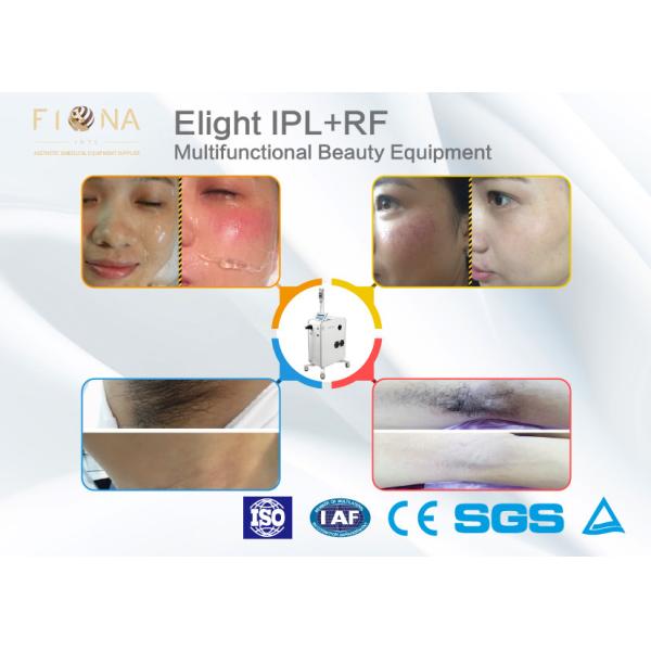 Buy 2000W E Light Ipl Machine , E Light Laser Hair Removal Machine Adjustable RF Energy at wholesale prices