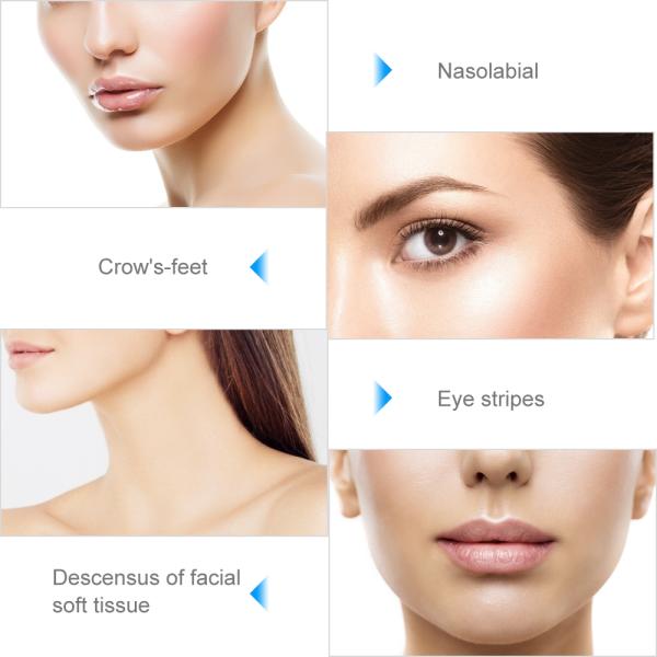 Rf Ems Electroporation Wrinkles Remove Eye Home Use Beauty Device