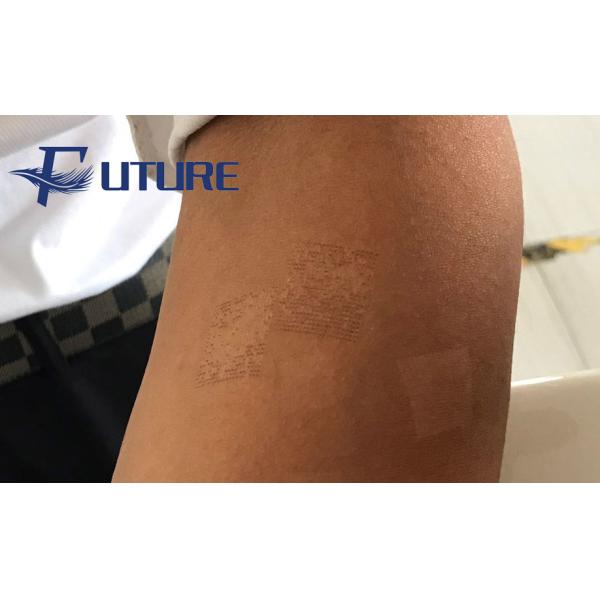 Co2 Laser Vaginal Rejuvenation Machine 0.1ms - 10ms Pulse Width For SPA / Clinic