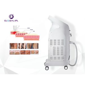 LCD 755 1064 808nm Alma Soprano Ice Platinum Laser