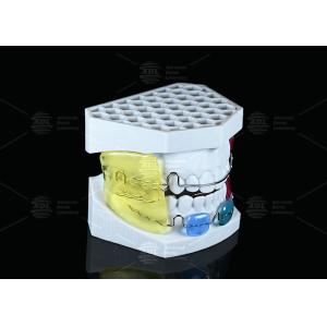 Children And Adults Frankel II Appliance Supporting Occlusion Recovery