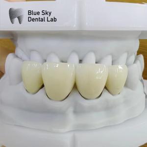 Natural Looking Layered Zirconia High Strength Zircon Multilayer Rectangular