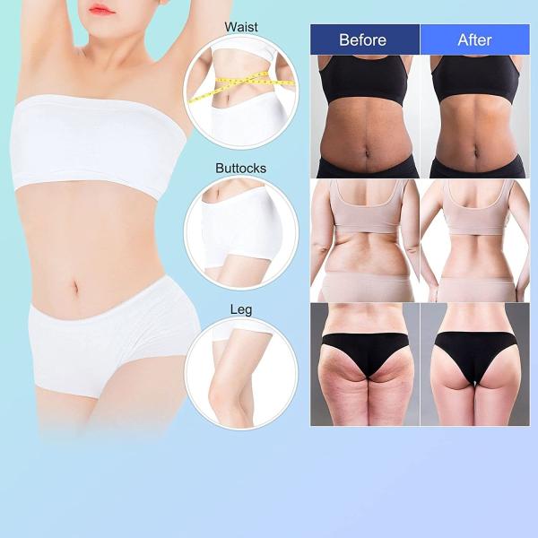 Lipo Cavitation Slimming Machine 125W 3 In 1 RF Skin Tightening Machine