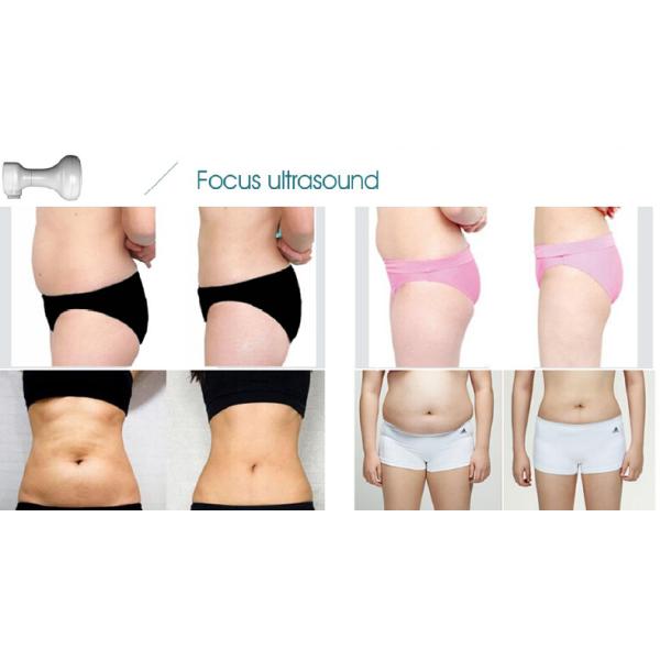 *New product looking for distributor! Hifu slimming machine