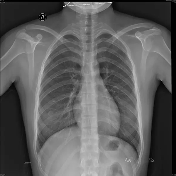 Buy Blue Laser X Ray Film For Single Use With Superior Print Quality at wholesale prices