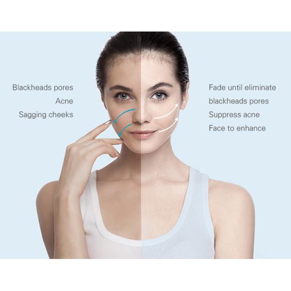 Skin Guardian!! IPL laser hair removal / IPL Skin Rejuvenation Machine Price / IPL machine price with CE from Weifang KM