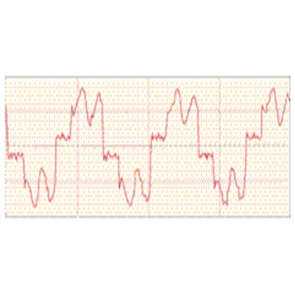 Cement Plant Three Phase 35KV 5000A Intelligent Power Saving System