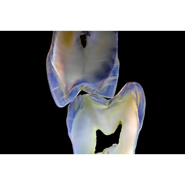 Buy Fixed Prosthetics Permanent Solution EMAX Dental Crown at wholesale prices