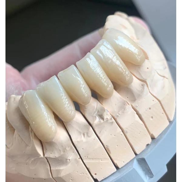 57% CAD CAM CNC Dental Multilayer Zirconia Block For 5 Axis Milling