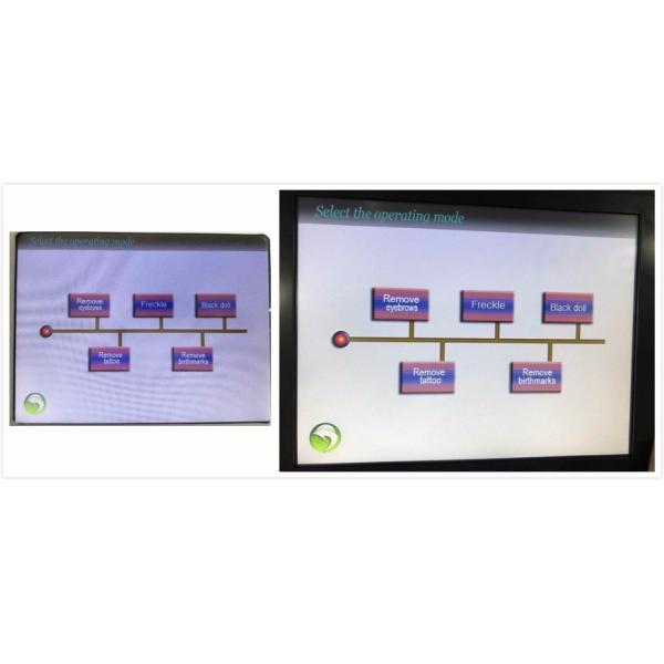 ND YAG LASER TATTOO REMOVAL - Portable Laser Machine Beauty System YL07