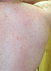 Powerful Permanent IPL Hair Removal Multifunction Beauty Machine with Wavelength