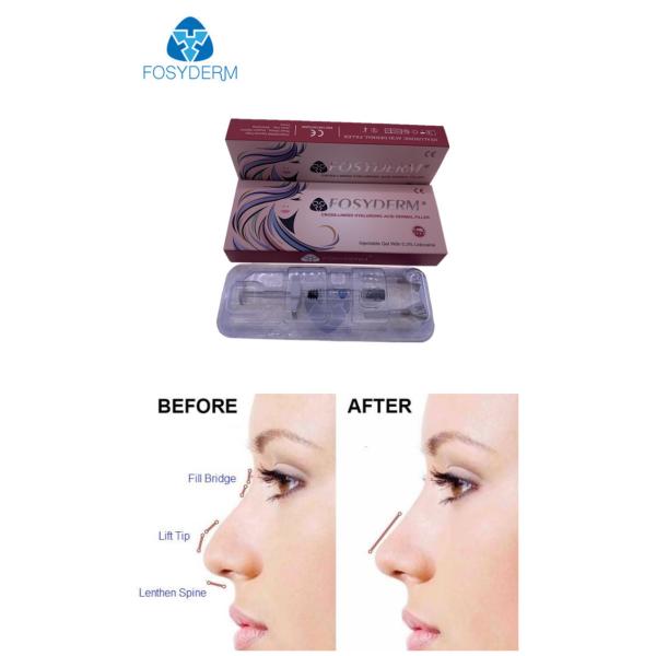 Fosyderm HA Dermal Filler Gel Injectable Nose Lips Filler 24mg/ml