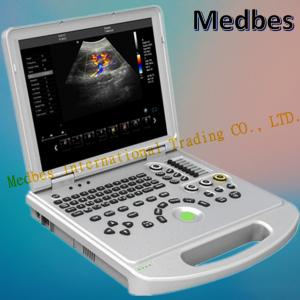 Quality Medical Device Portable Ultrasound Scanner in Hospital for sale