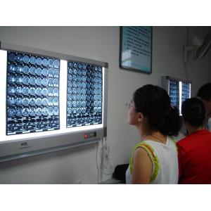 Dry Laser Medical X Ray Dry Film 10in x 12in For Fuji Printers