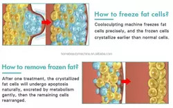 cryolipolysis slimming machine